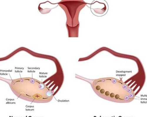 代生技术-羊水穿刺医保能报销吗