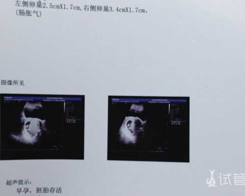 天津代孕网多少钱【试管国内合法吗】