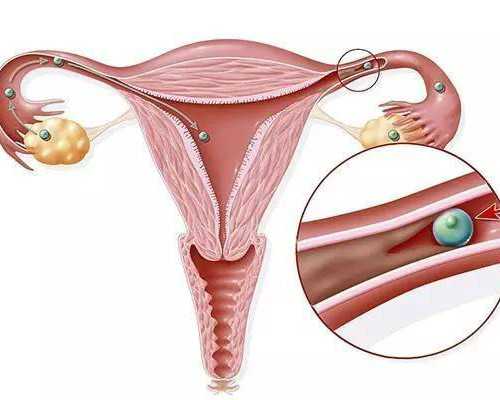 北京供卵助孕公司试管生男孩排名？