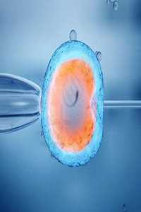 什么地方代孕便宜,衡